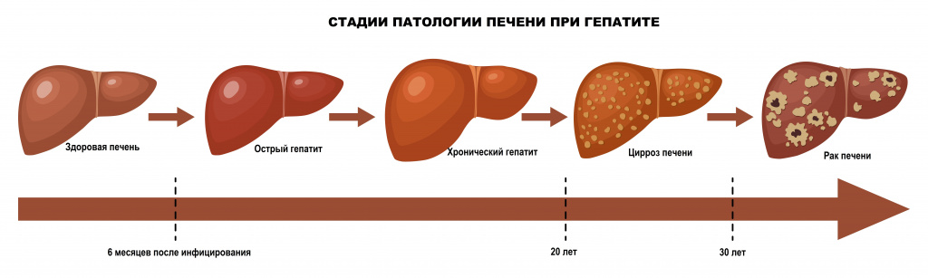 Гепатит